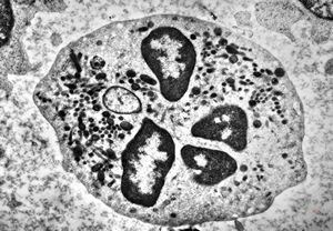 blood - neutrophilic granulocyte blood - neutrophilic granulocyte